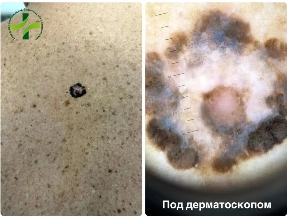 Клинический случай